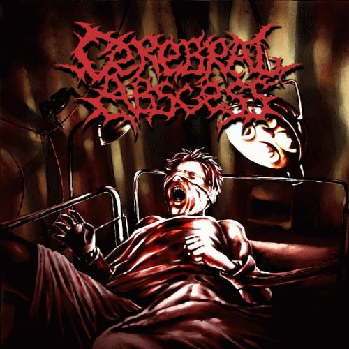 Cerebral Abscess : Demo 2012